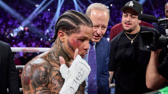Gervonta Davis shows off the wounds of battle.