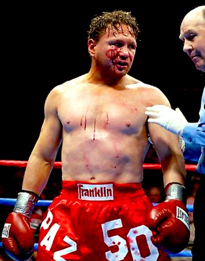 Vinny Paz returned to boxing 13 months after being involved in a horrific auto accident that doctors said would mean the end of his boxing career. Vinny Paz returned to boxing 13 months after being involved in a horrific auto accident that doctors said would mean the end of his boxing career.